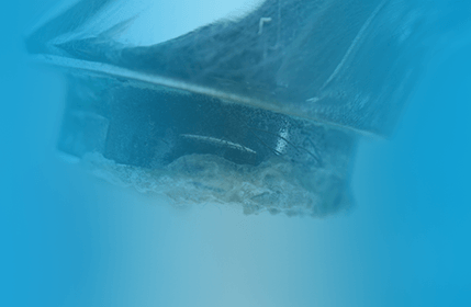 Жорсткий і жовтий наліт